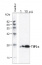TIP1;1,TIP1;2 | tonoplast intrinistic protein1-1, 1-2 (gamma)